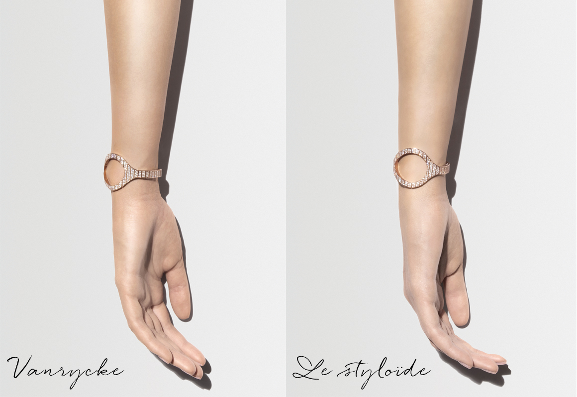 ImageT styloide